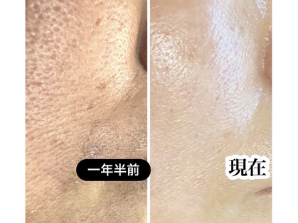 スティーン(Styin)の写真