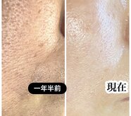 スティーン(Styin)