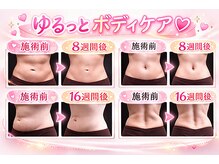 ビバク 吉祥寺駅前店(BIBAKU)の雰囲気（結果重視の方にオススメ！）