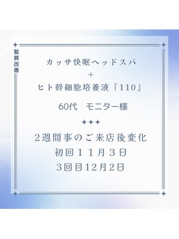 エンフク(Enfuku,)/カッサ快眠ヘッドスパ+髪質改善