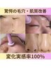 夏前の絶対キレイメンテナンス！！毛穴レス【お肌プロセル】8時間洗顔不可