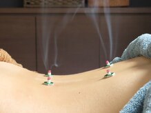 吉祥寺みやま鍼灸院/お灸