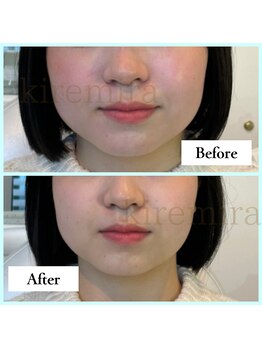 キレミラ 麻布十番店/赤み編