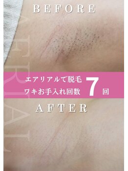 エアリアル 南行橋店/当てるほど効果の違いを実感