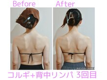 ルル(Ruru)/韓国コルギ＋背中リンパ/3回目