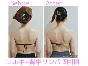 ルル(Ruru)/韓国コルギ＋背中リンパ/3回目