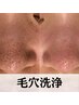【再来/フェイシャル1ヶ月以内割有】全顔3D毛穴洗浄