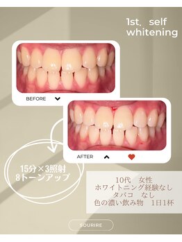 スリール(sourire)/