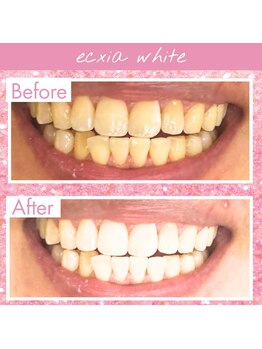 エクシアホワイト 倉吉店(ecxia white)/ビフォーアフター