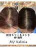 【抜け毛/分け目に◎完全個室】プロセルセラピーズ/頭髪育毛促進カウセリング
