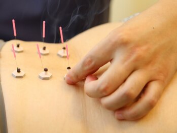 よしおか鍼灸院/