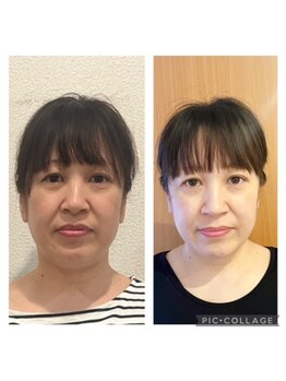 ナチュラルセラピー ドロップ(Drop)/小顔で見た目年齢は変えられる