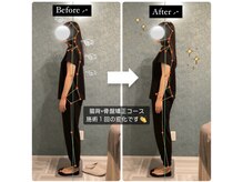 ラクリエ 姫路駅前院(La Creer)/施術ビフォーアフター/猫背/肩