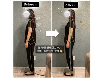 ラクリエ 姫路駅前院(La Creer)/施術ビフォーアフター/猫背/肩