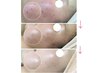 【乾燥肌・赤ら肌・敏感肌】妊娠中や授乳中の方にも♪20,000→11,000