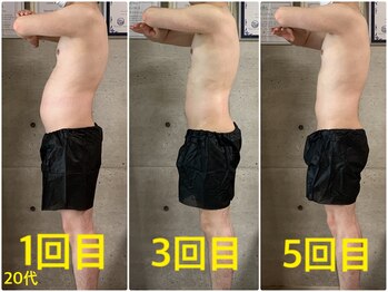 ペリー(PELLY)/男性20代 before after