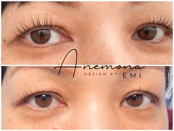 アネモナ(ANEMONA)/design by〉EMI