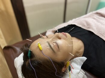 いりや鍼灸整骨院/美容鍼