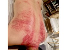 ビレイ(Birei)/カッサ