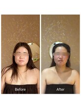 コンジュ(kongju)/小顔コルギ