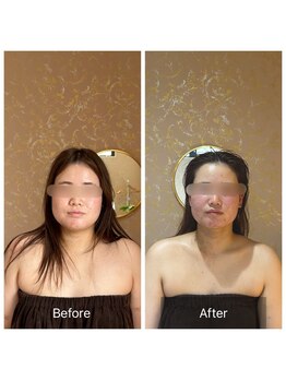 コンジュ(kongju)/小顔コルギ