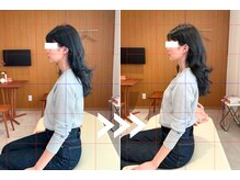 リリーフポート フェミナ鍼灸整体院 大濠公園店/スマホ首が解消【首こり頭痛】