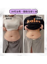 グランディールアン(GRANDIR UN)/施術直から1週間でこの変化