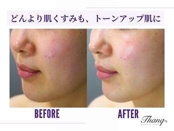 サンク(Thanq)/くすみ・肌の疲れケア