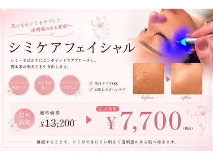 ラディアンスの写真