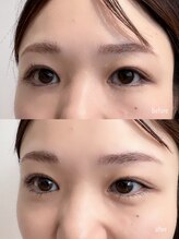 シューナランド(schoner Rand)/上下ラッシュリフト