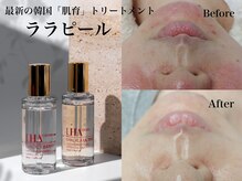 カラット(CARAT)
