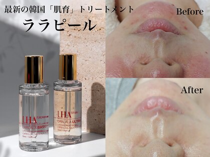 カラット(CARAT)の写真