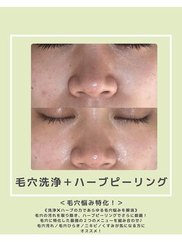 ソワナ(soina)/【神楽坂駅/フェイシャル/毛穴】