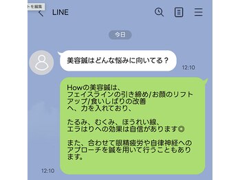 ハウ(How)/よくある質問1(美容鍼ver)