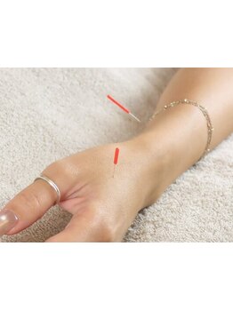 鍼灸施術を受けたい