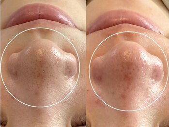 アンベリール(Embellir)/松ヤニワックス♪