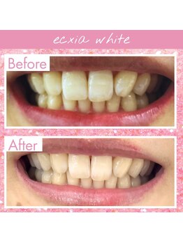 エクシアホワイト 倉吉店(ecxia white)/ビフォーアフター