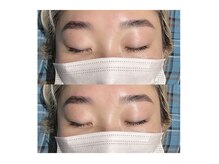 グランウィーユ バイ ロンド 銀座(Grand oeil by Lond)/ハリウッドブロウリフト