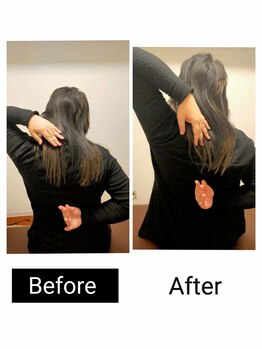 アース エンジェル整体院/ビフォアフ 肩甲骨はがし