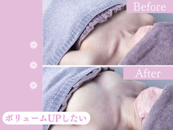 キアナ 横浜店(Kiana)/バストアップBefore After