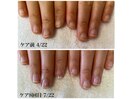 最強ケア3ヶ月コース8回目