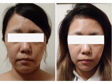 クレール(clair)/New　EMS美顔器おすすめです！！