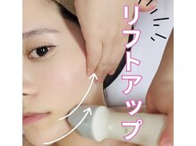サロンドジェシカ(salon de Jessica)の雰囲気（フェイスラインの脂肪を分解＆引き締め！お試し価格¥6,900♪）