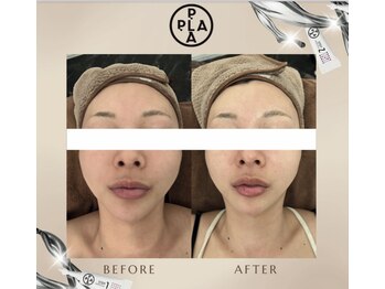 エミア(Emia)/韓国発☆プラチナ・プラピール