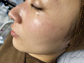 プニュ(Peau nue)の写真/ツルツル＆透明感のあるお肌へ☆美活菌である乳酸菌を毎日のスキンケアにプラスする事で、お肌の底力UP!