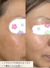 キレイノココロミ(きれいのCoCoRomi)/