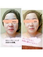 エステティックシトラス(esthetic CITRUS)/before & after