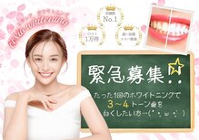エクシアホワイトニング 金沢香林坊店