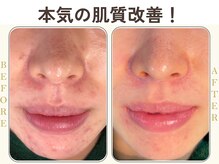 サロンアン(Salon an)