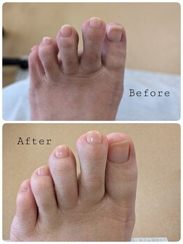 リゼラアンドコー 旭川店/before　after